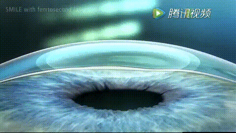 全飞秒.gif