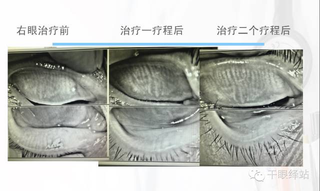 爱尔眼科医院