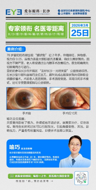 角膜案例1.jpg